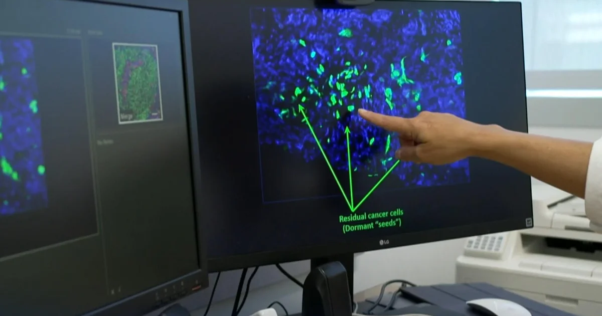 Featured image for Scientists Target Dormant Cells to Prevent Breast Cancer Recurrence