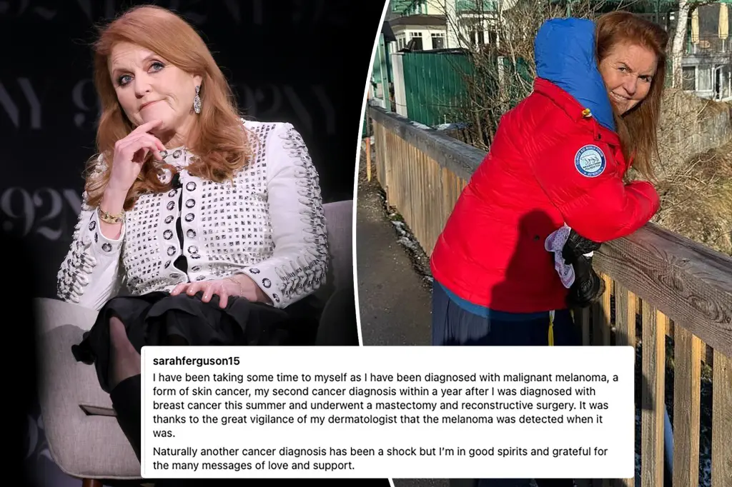 Sarah Ferguson's Aggressive Skin Cancer Diagnosis: A Distressing Revelation