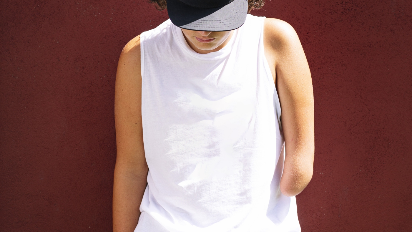 Featured image for Brain's Body Map Remains Stable Despite Limb Loss