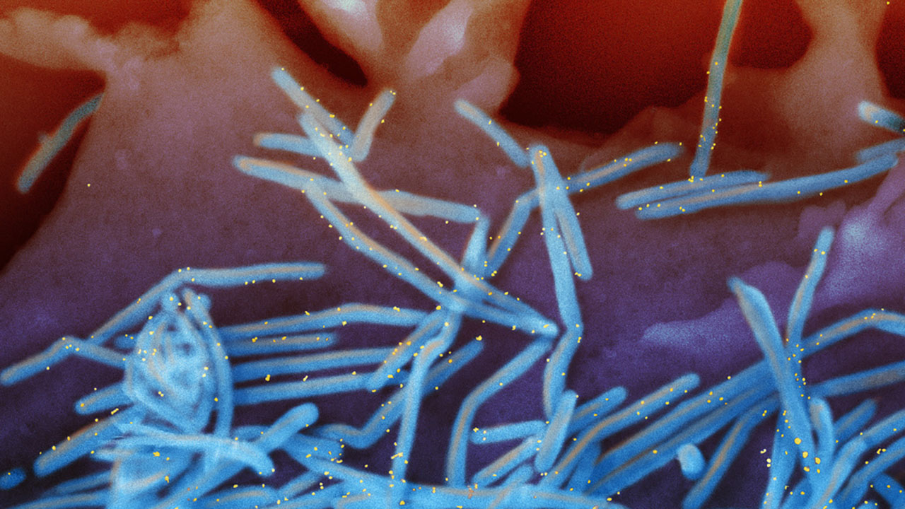 Featured image for Multiple Respiratory Viruses Pose Threat for Fall and Winter Season