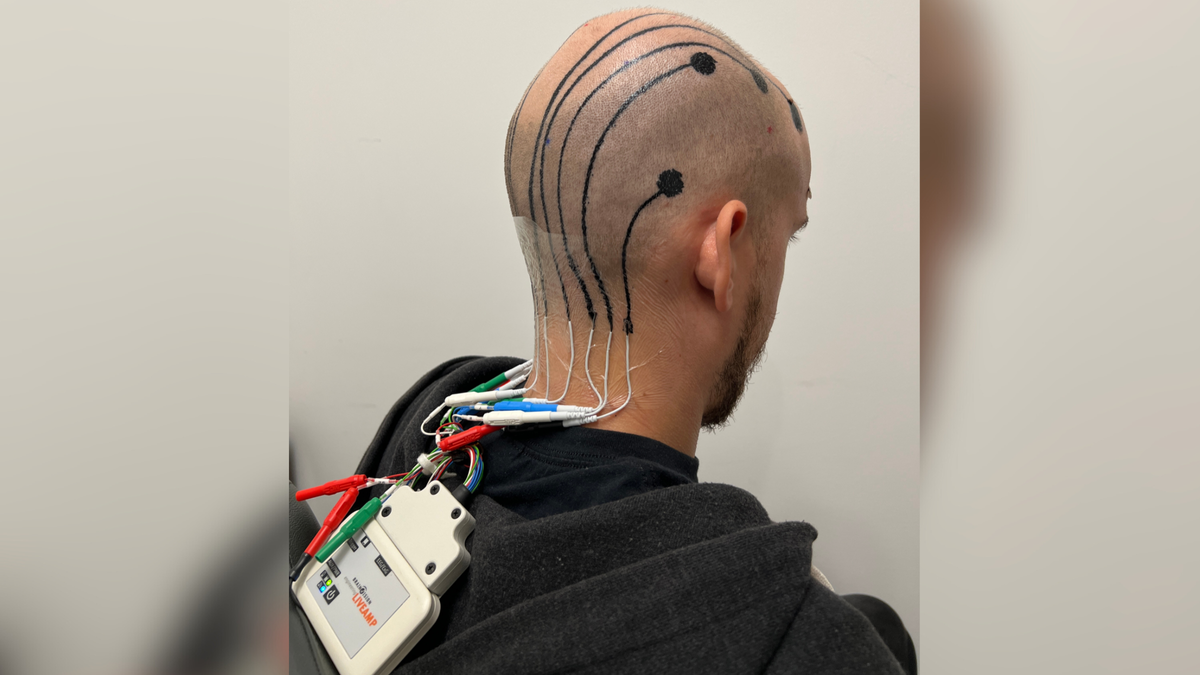 Featured image for Revolutionary Scalp Tattoos Transform Brain Monitoring Technology
