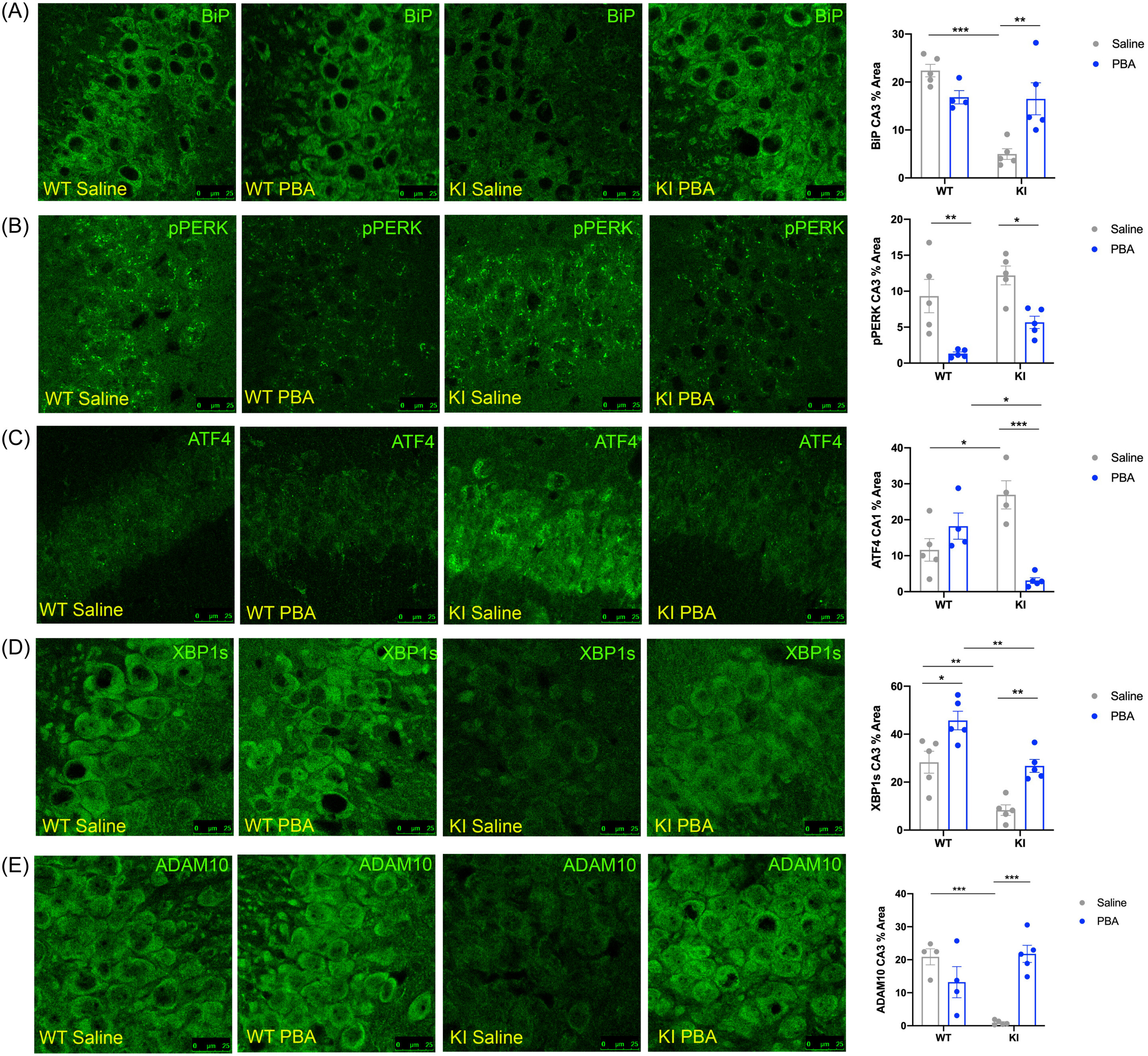 Featured image for Promising Alzheimer's Treatment Restores Memory Function in Preclinical Study