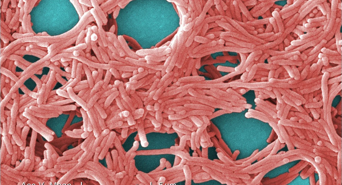 Featured image for Legionnaires' Disease Outbreak in NYC and Beyond: Multiple Deaths and Growing Cases