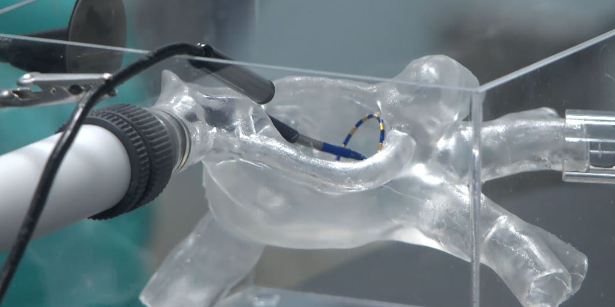 Featured image for "Hospitals Introduce Innovative AFib Treatments with Tissue-Sparing Procedures"