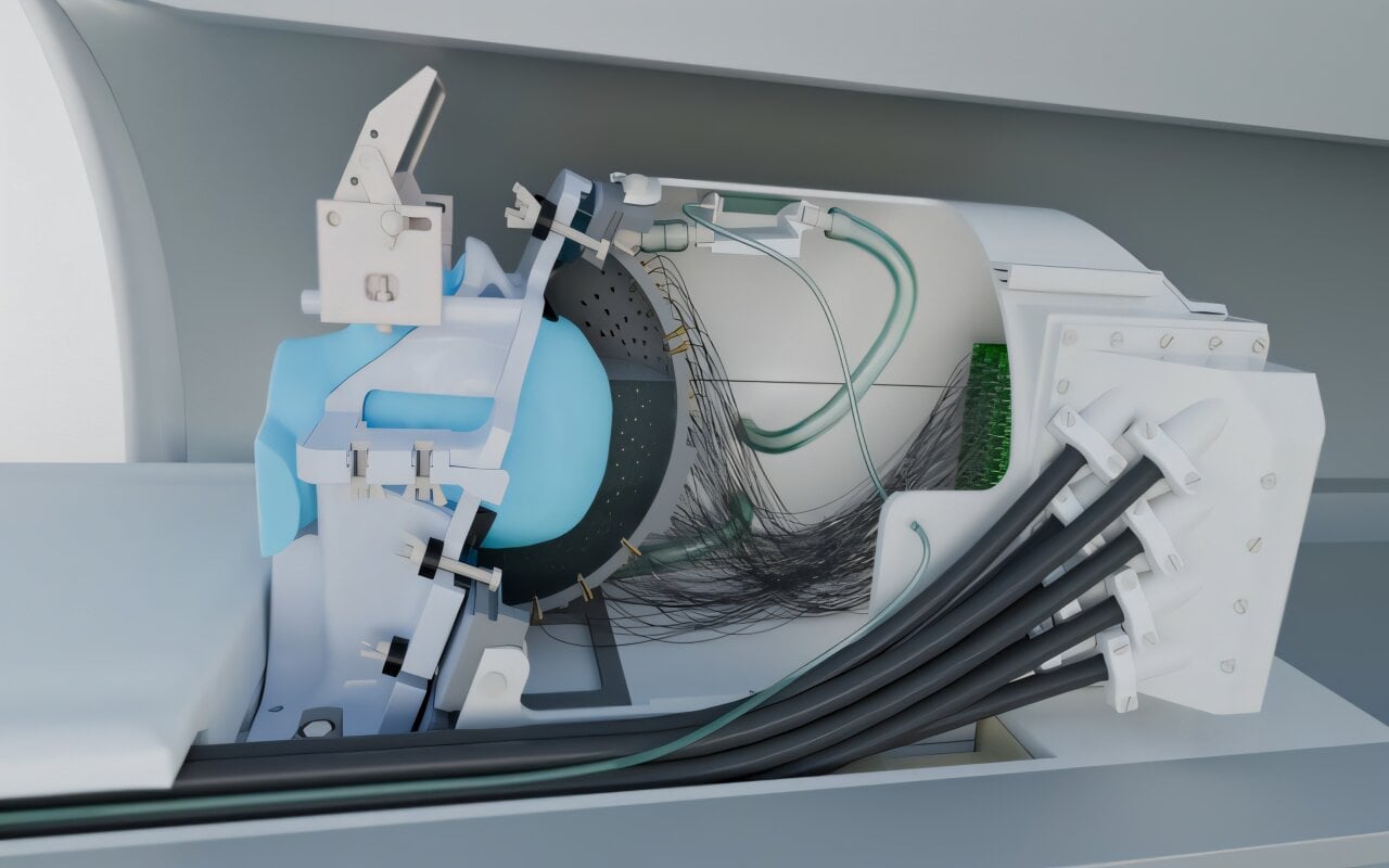 Featured image for Ultrasound Helmet Offers Non-Invasive Parkinson’s Treatment Hope