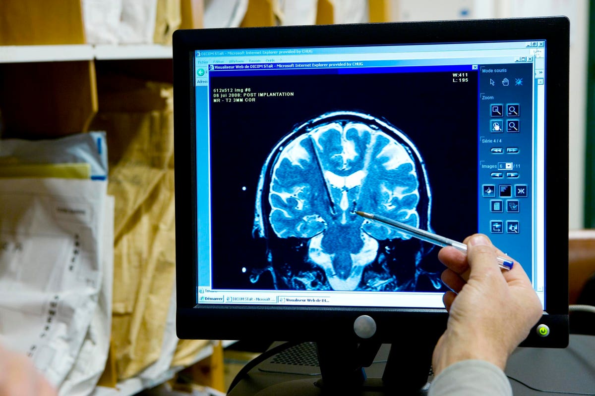 AI's Impact on Treating Neurological Disorders and Brain Adaptability