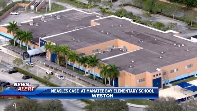 Featured image for Measles Confirmed at Broward County Elementary School