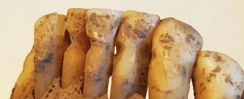 Featured image for "Advanced Dental Techniques Uncovered in Viking Teeth Study"