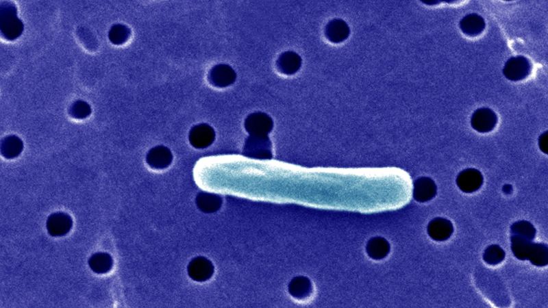 Featured image for Florida warns of raw milk risks after 21 illnesses from bacteria outbreak