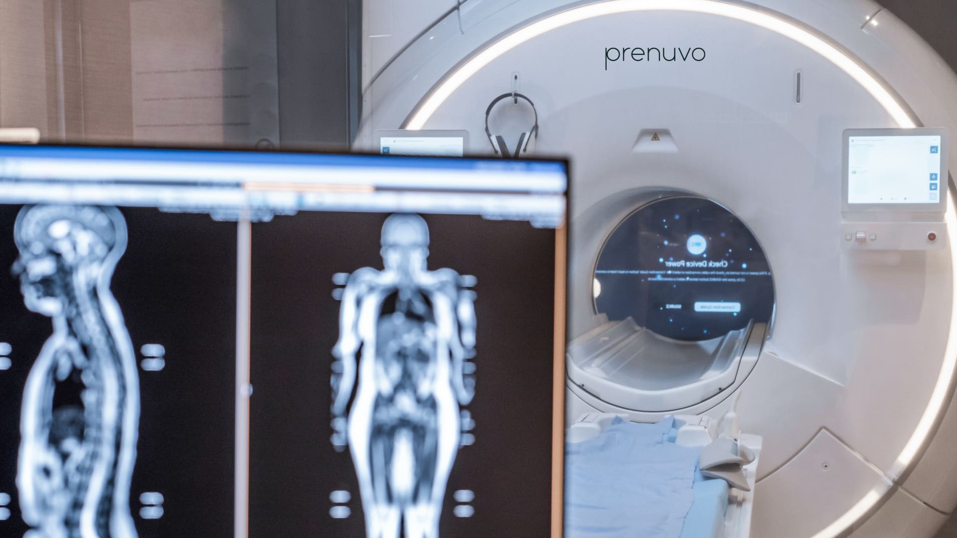 Featured image for "Affordable Full-Body MRI Scans Revolutionize Early Cancer Detection"