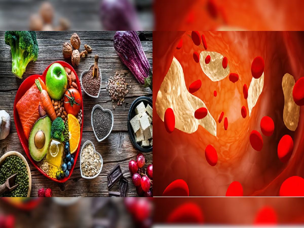 "Powerful Foods and Herbs for Lowering Cholesterol Naturally"