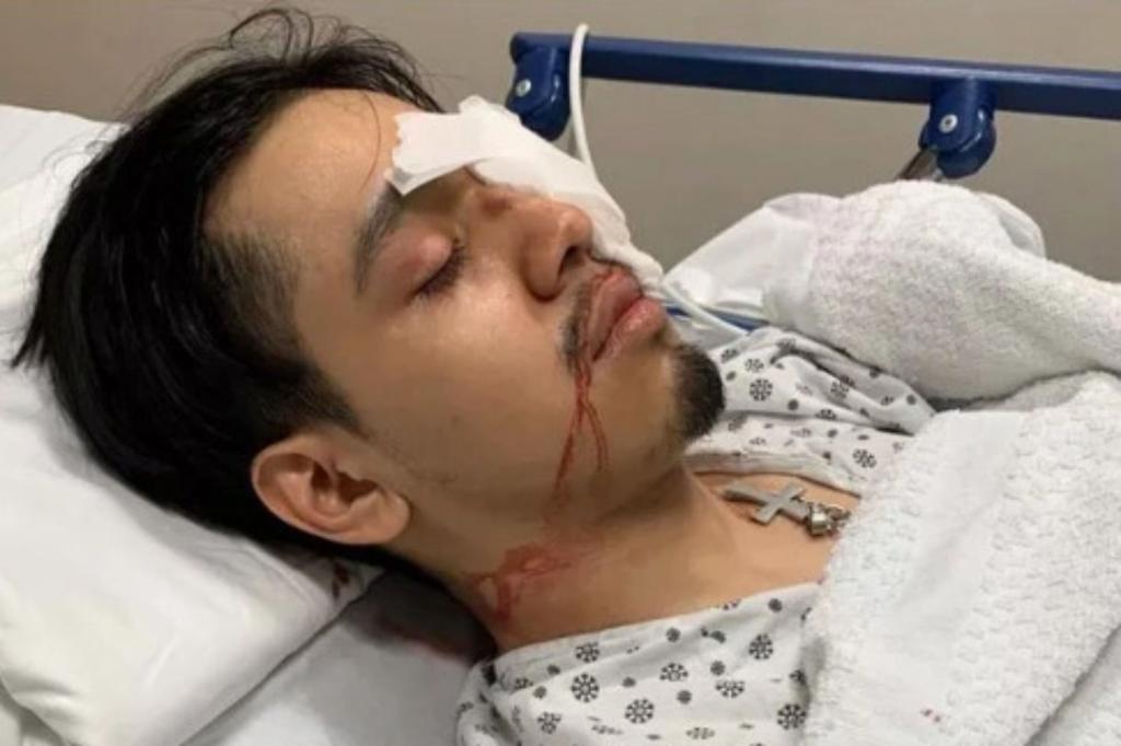 Featured image for Blind Manhattan man sues city and MTA over subway attack and negligence.