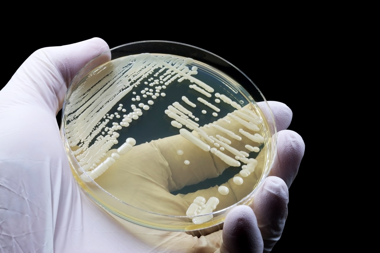 Featured image for Rising Threat: Deadly Superbugs Spread Across Multiple States