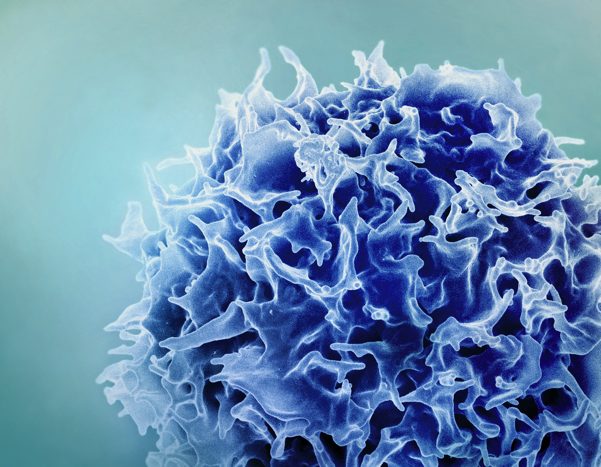 Featured image for CAR-T therapy adapted for rare autoimmune disorder treatment.