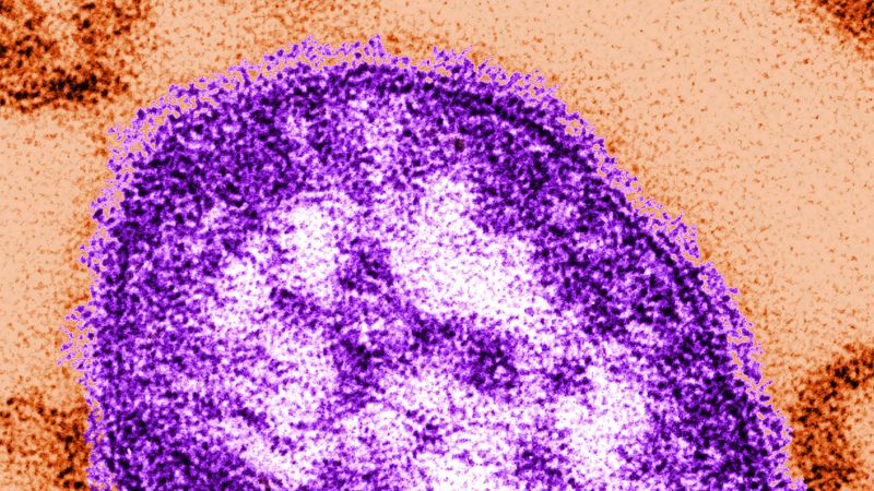 Featured image for Measles Outbreak in South Carolina Surpasses 200 Cases Amid Vaccination Concerns