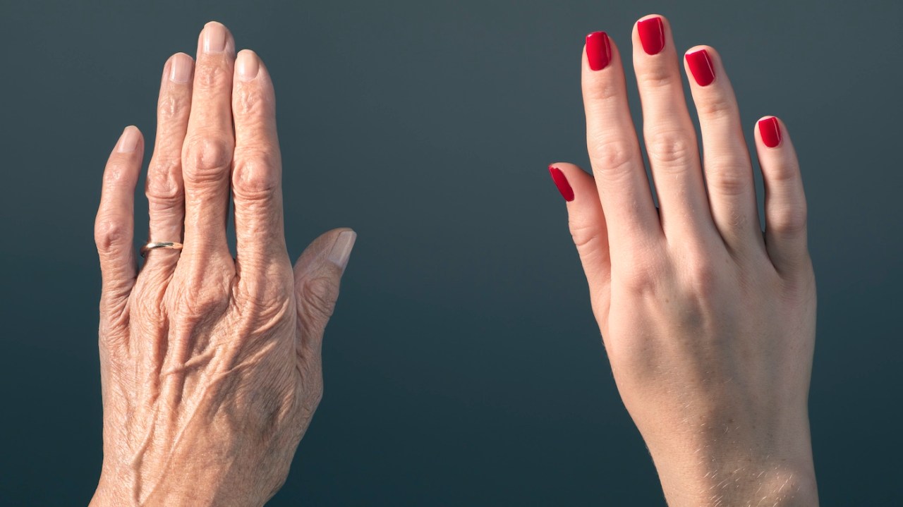 "Link Between Accelerated Aging and Increased Cancer Risk in Young Adults"