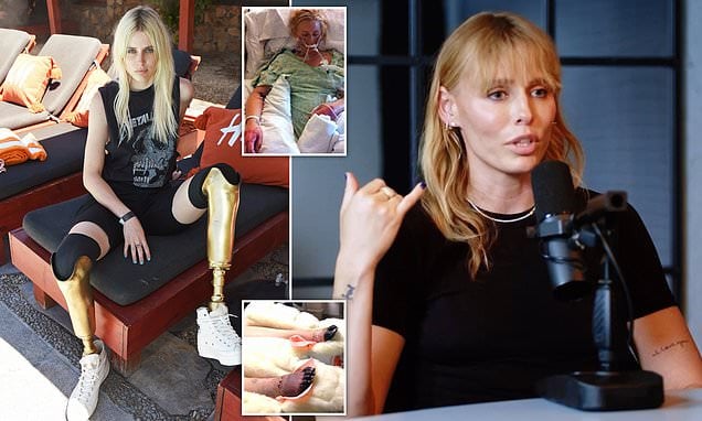 Featured image for Surviving Tragedy: From Near-Death to Success, Despite Losing Both Legs to a Tampon