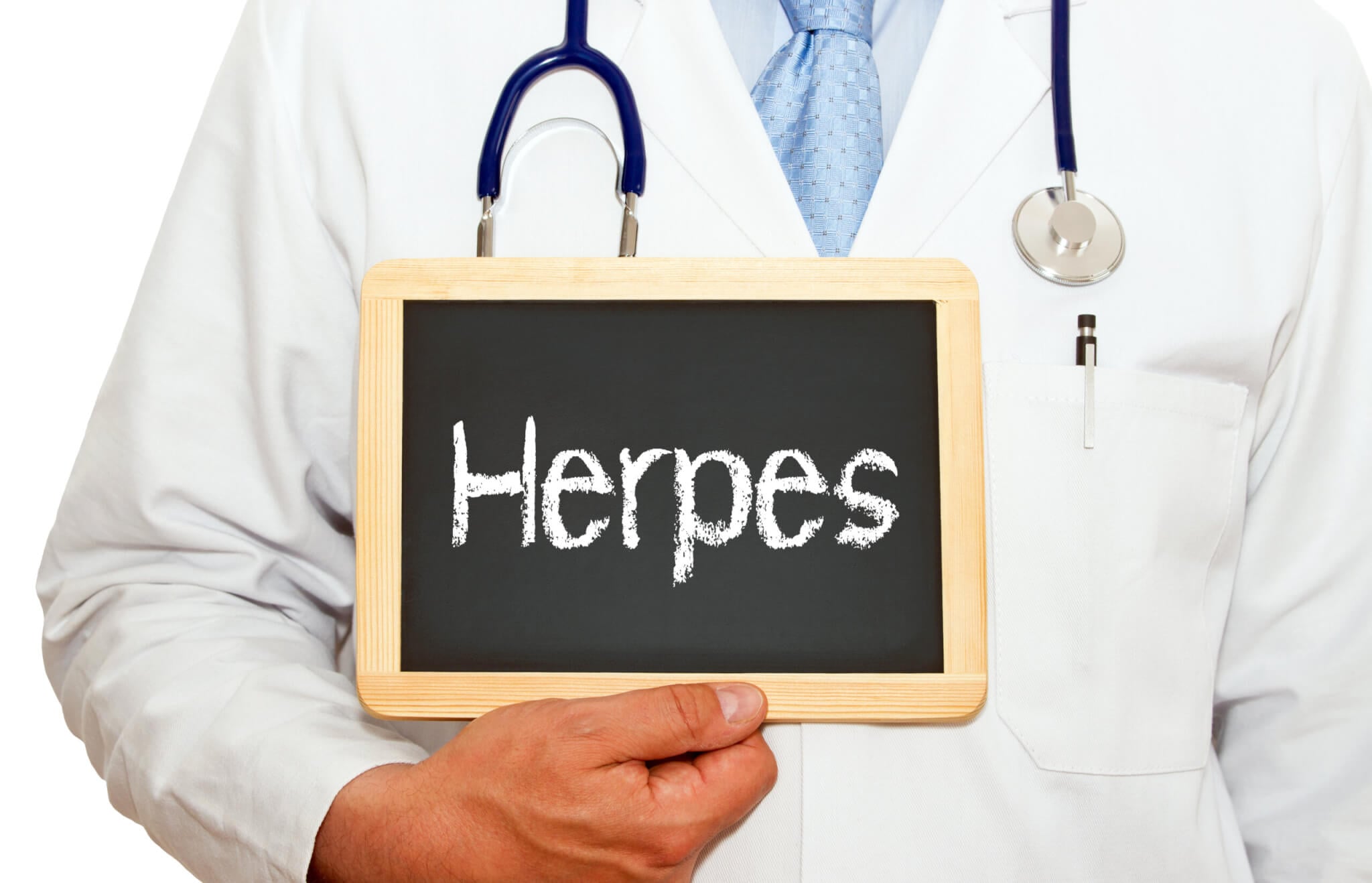 Featured image for Global Genital Herpes Affects Over 20% of Adults, WHO Reports