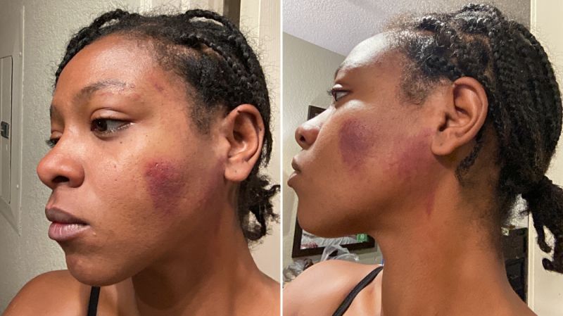 Controversial CMPD arrest: Woman speaks out after being hit by officer