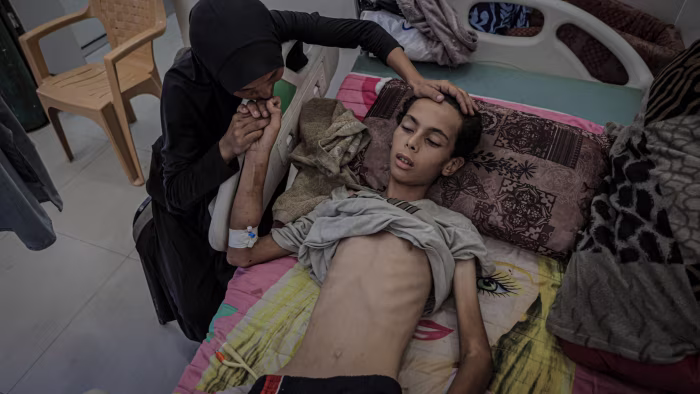 Featured image for Gaza Faces Escalating Starvation Crisis Amid Ongoing Conflict