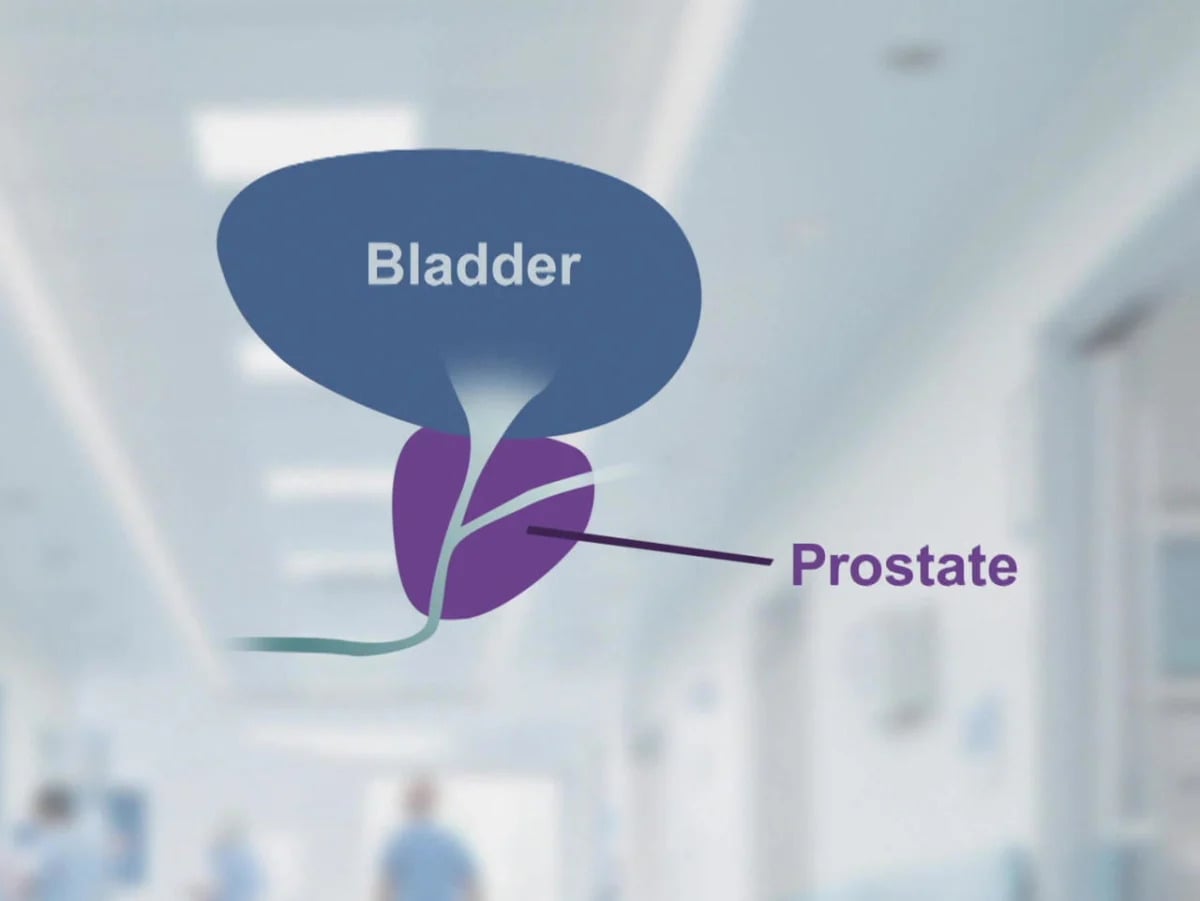 Featured image for "The Prostate: Understanding its Impact on Men's Health"