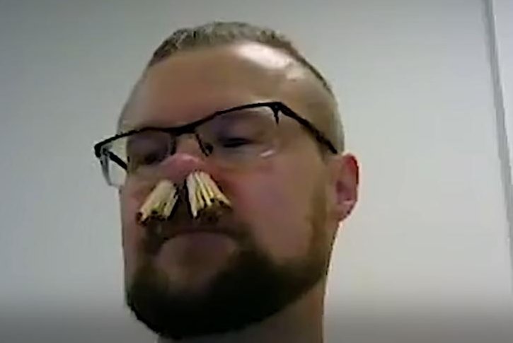 Featured image for Danish Man Shatters Record by Inserting 68 Matchsticks into His Nose
