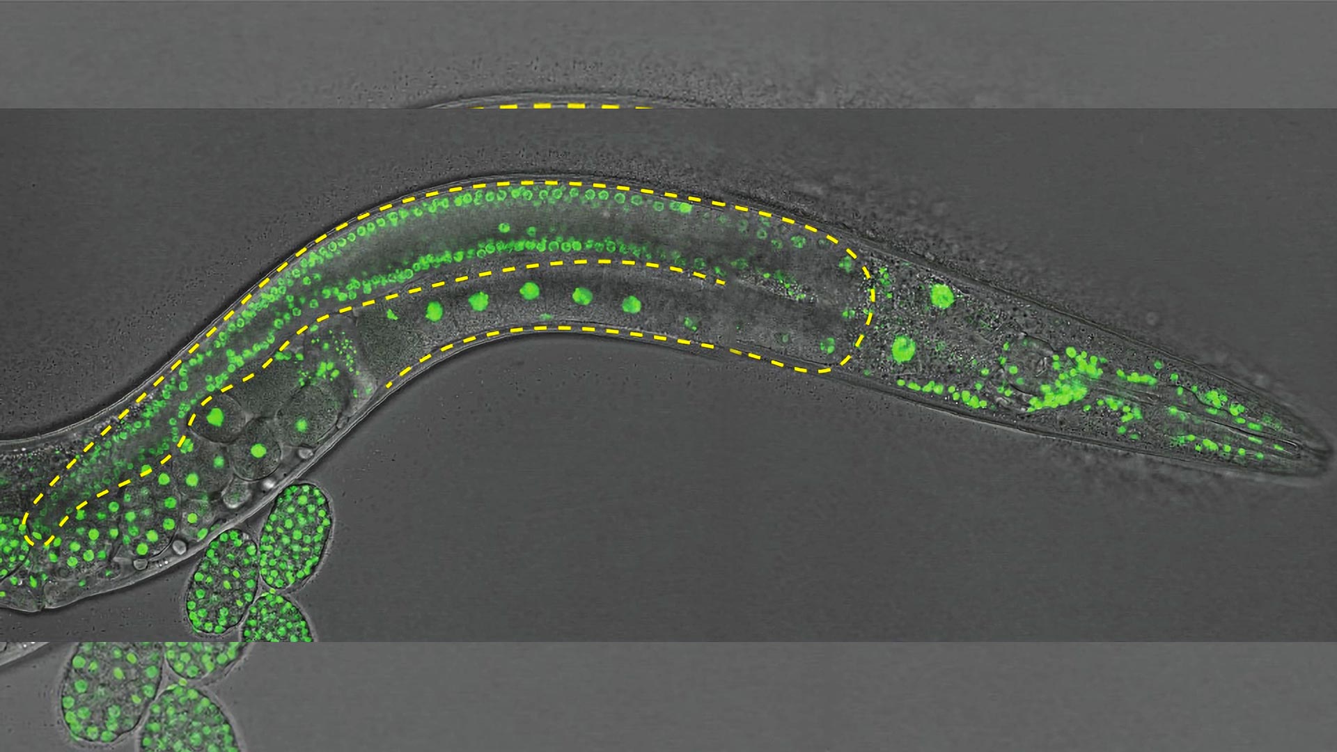 Featured image for Surprising Insights into Cell Differentiation from Worm Research