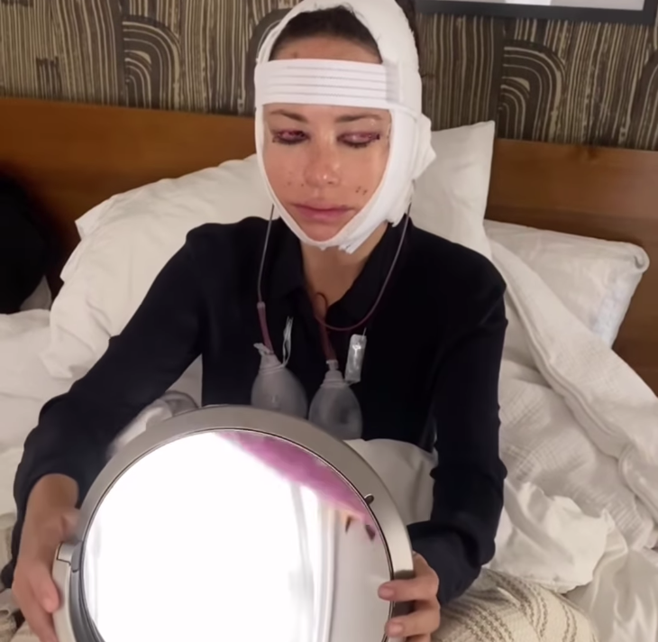 Catt Sadler's Candid Confession: Facelift at 48.