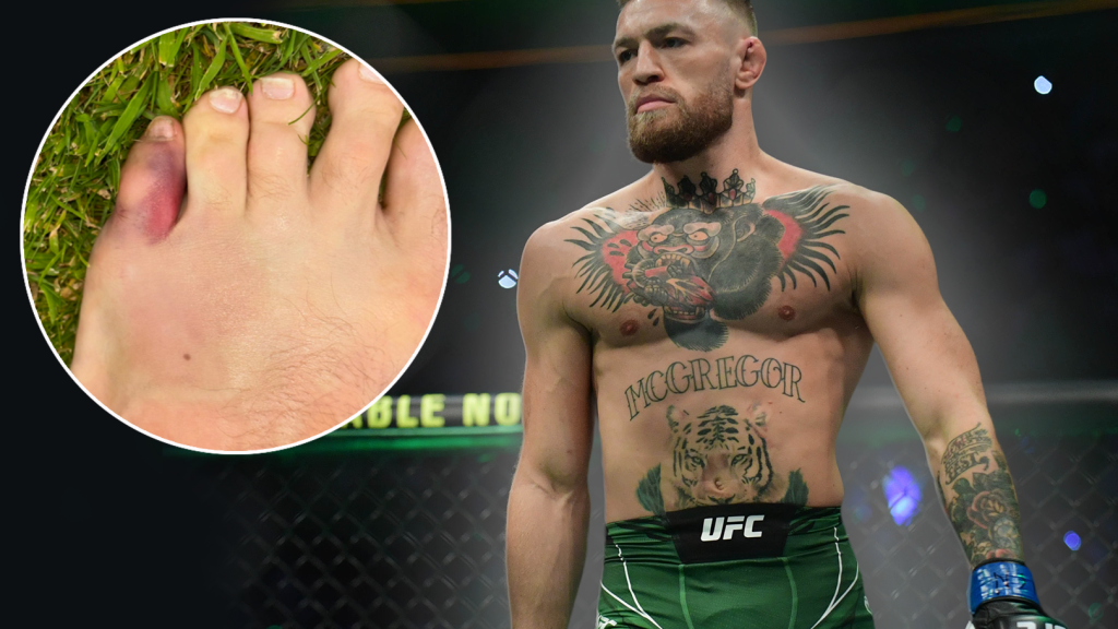 Featured image for Conor McGregor Withdraws from UFC 303 Due to Broken Toe