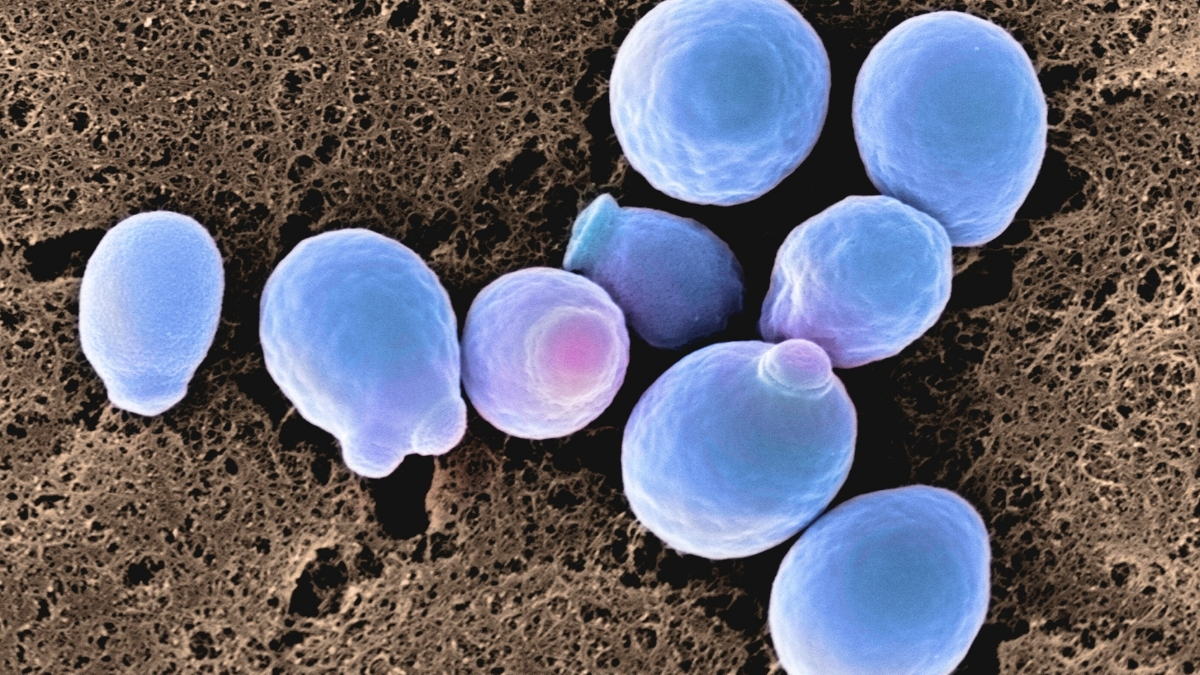 Featured image for Scientists Warn of Growing Drug Resistance in Common Infections