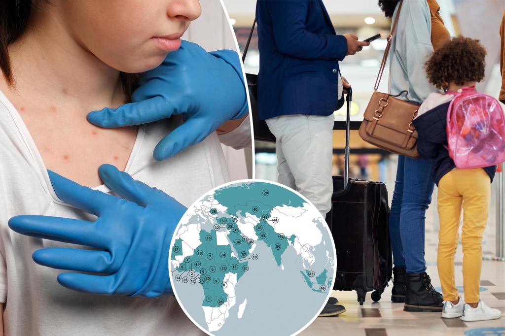 Featured image for "Measles Outbreaks: CDC's Updated Travel Guidance and Expert Advice"