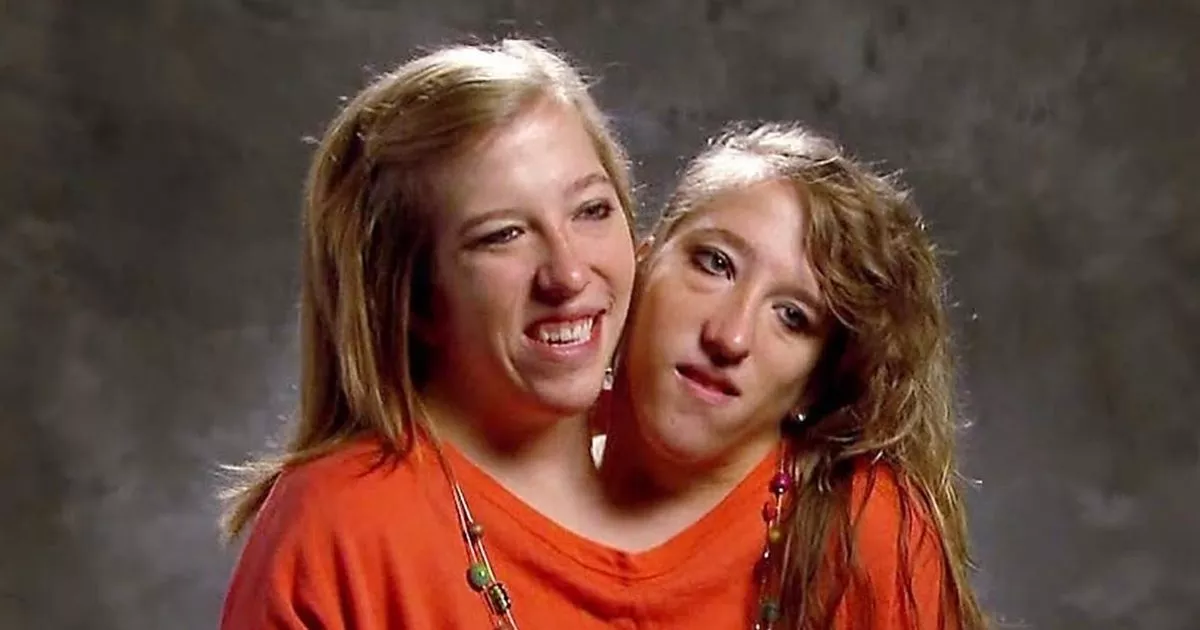 Featured image for Conjoined Twins Abby and Brittany Hensel Enjoy Rare Outing with Newborn