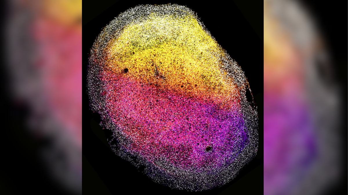 Featured image for "Revolutionizing Neuroscience: Mini-Brains Grown from Human Fetal Tissue"