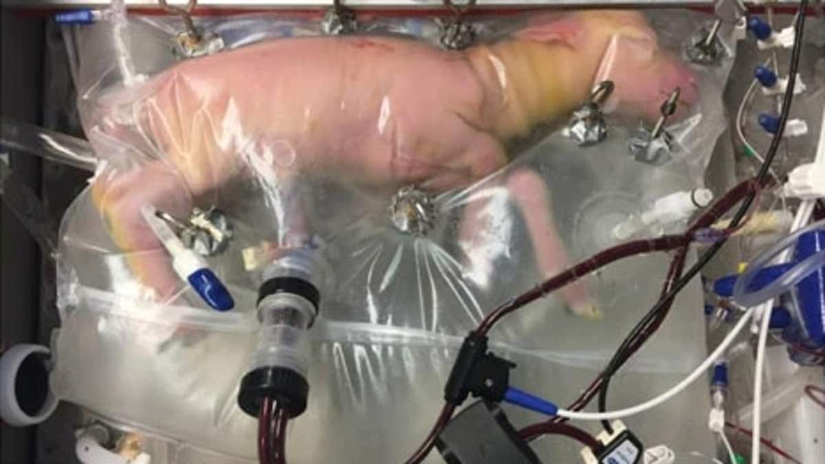 Featured image for "Artificial Wombs Show Promise for Premature Babies Amidst Feminist Debate"
