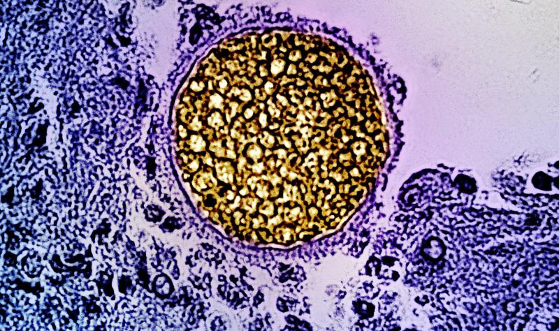 Featured image for US Valley Fever Cases Likely 18 Times Higher Than Reported