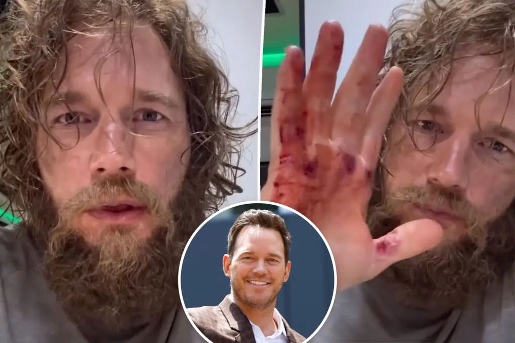 Featured image for Chris Pratt Unrecognizable in Dramatic Transformation for New Role