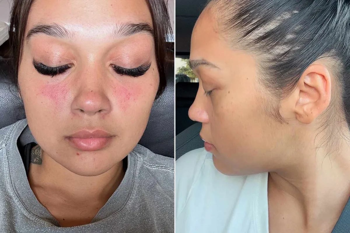 Misdiagnosed and Misjudged: Woman's Weight Blamed for Serious Disease