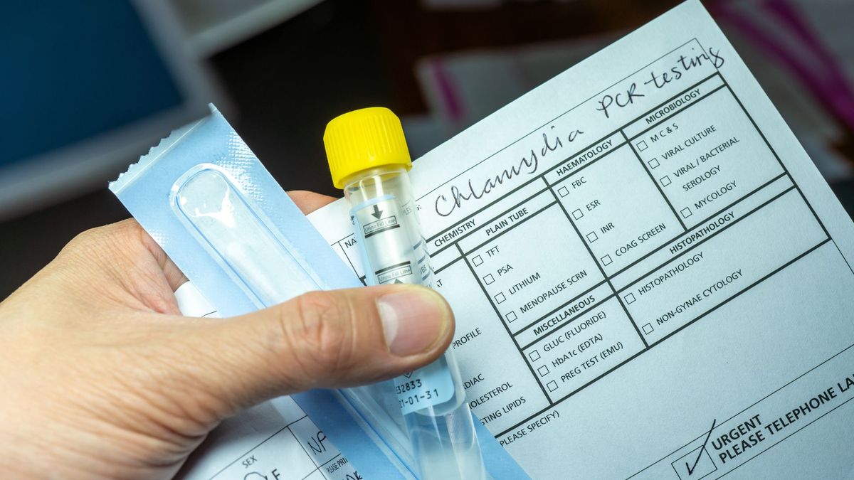 The Alarming Increase of STIs in the US.