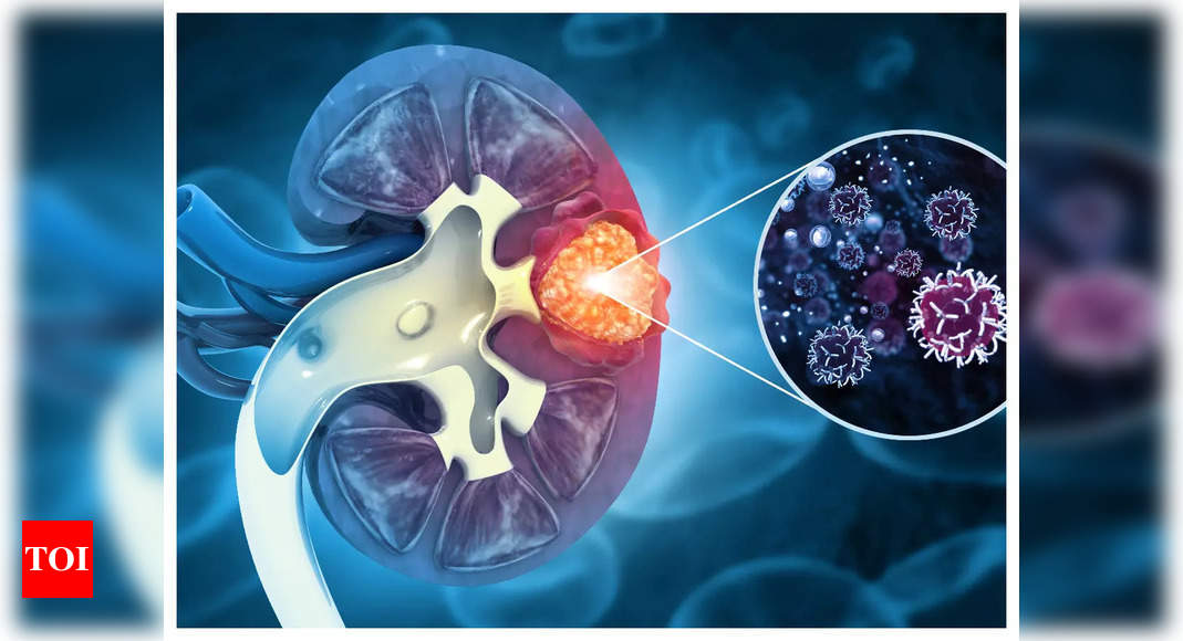 Decoding the Similar Symptoms of Kidney Stones and Gallbladder Stones.