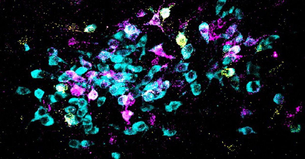 Unraveling the Mechanisms of Fear in the Brain