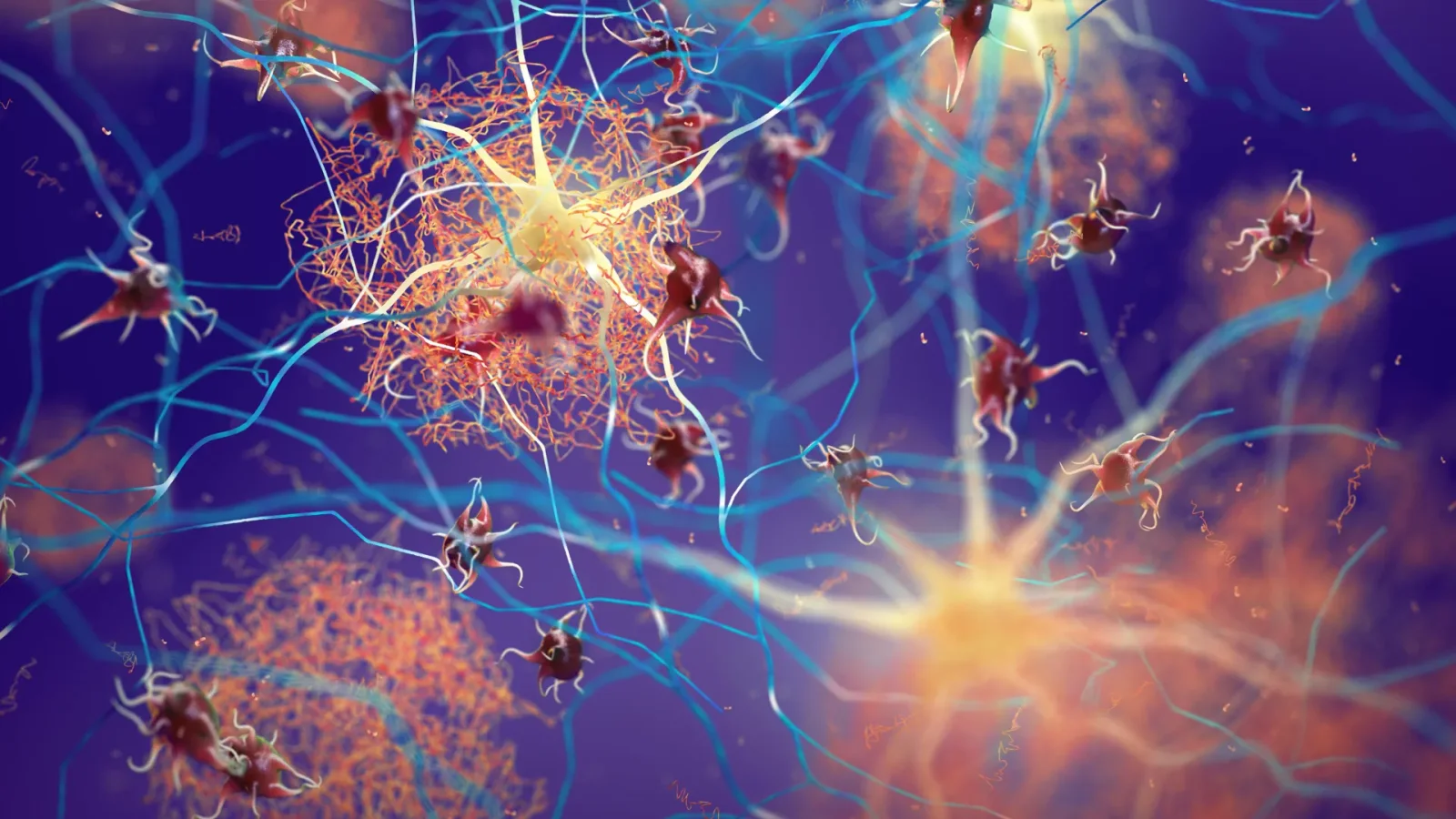 Brain receptors boost brain's natural cleaner to reduce Alzheimer's plaques