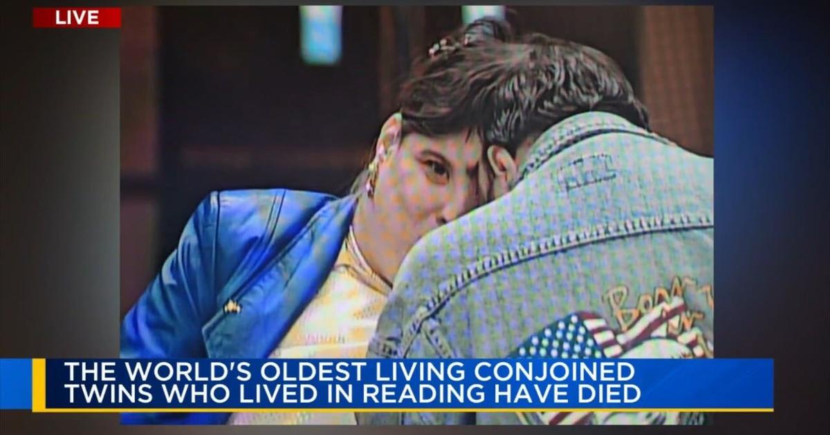 Featured image for "Oldest Conjoined Twins, Lori and George Schappell, Pass Away at 62"