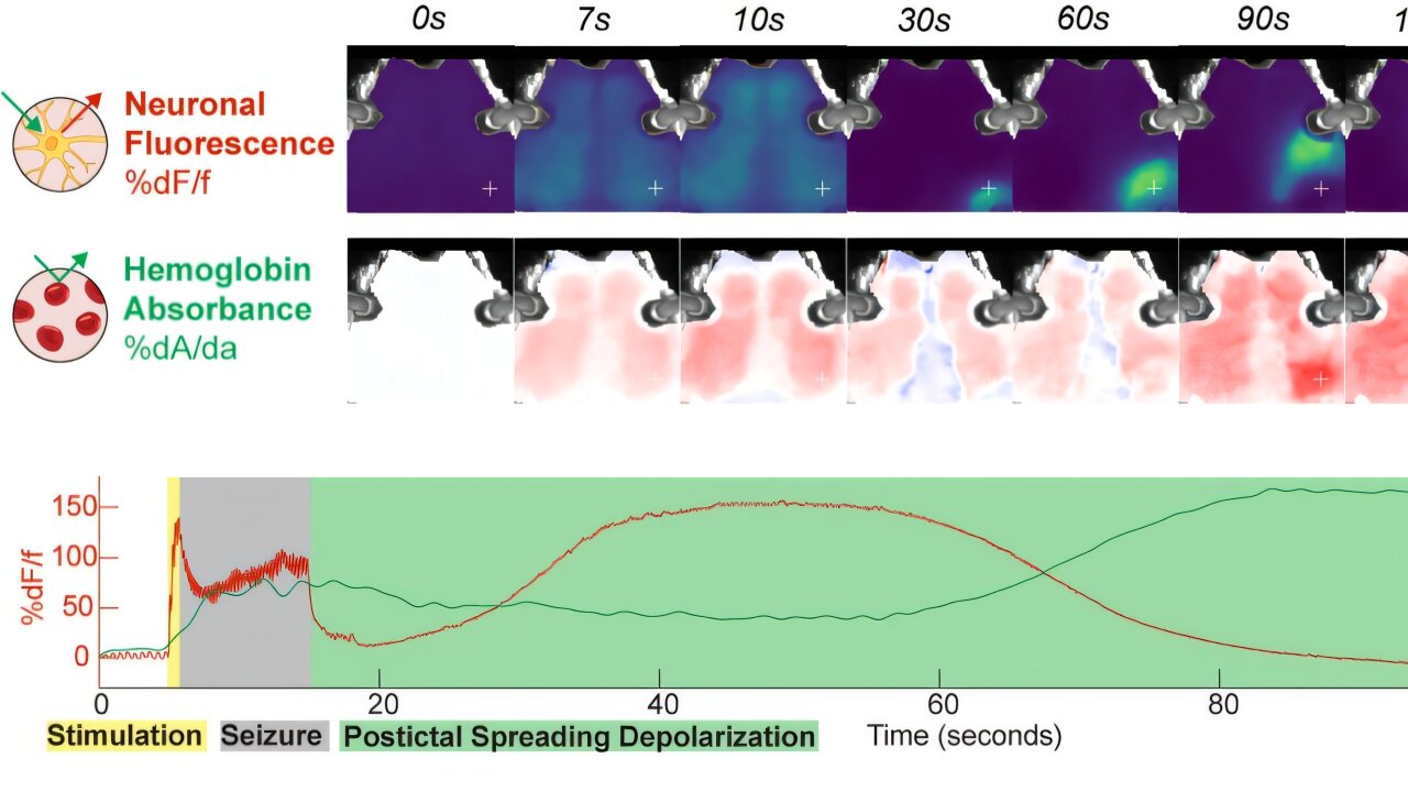 Featured image for Brain Wave Discovery Challenges Beliefs About Electroconvulsive Therapy's Reset Effect