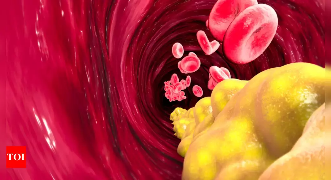 Featured image for "Unlocking a Healthy Heart: Proven Strategies to Prevent Blockages and High Cholesterol"