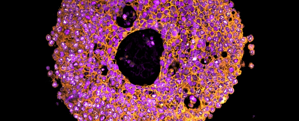 Featured image for Breakthrough in 3D-Printed Placenta Models Enhances Pregnancy Research