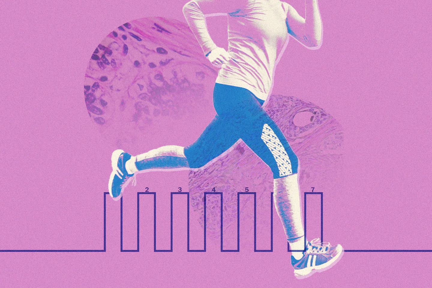 Exercise session may inhibit cancer cell growth, study finds