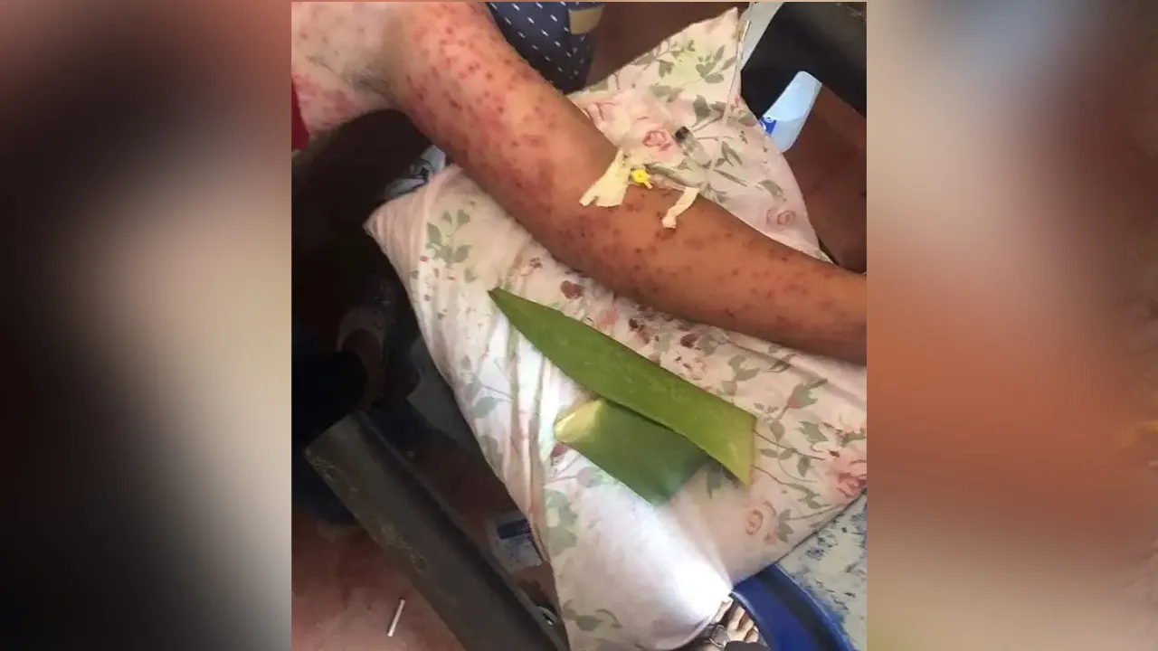 'Killer Bees' Claim 6 Lives in Nicaragua Bus Crash