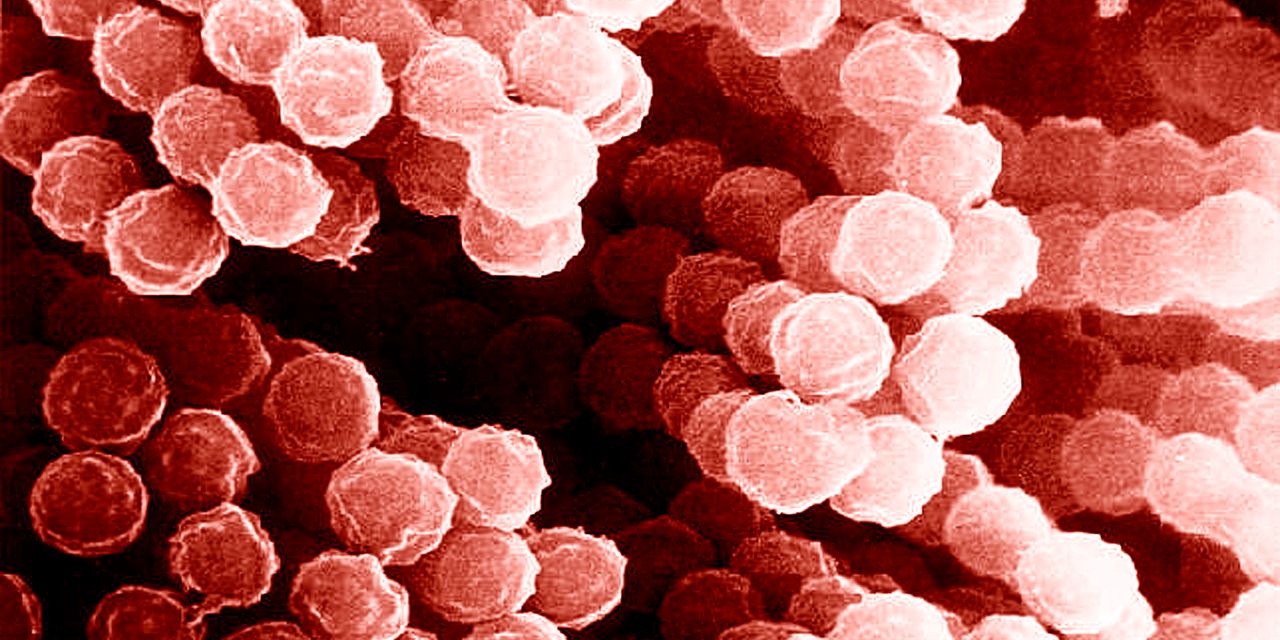 Featured image for The Uphill Battle for Doctors Fighting Deadly Fungi.