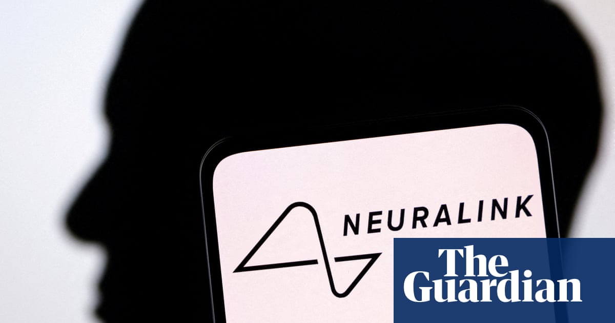 Neuralink Brain Implant Approved for Human Testing: Should We Be Concerned?