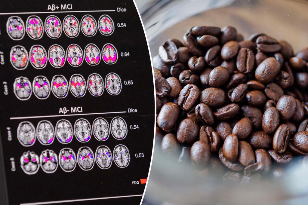Featured image for The Surprising Link Between Espresso and Alzheimer's Prevention